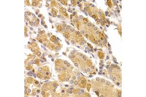 Immunohistochemistry of paraffin-embedded human stomach using ART5 antibody at dilution of 1:100 (x400 lens). (ART5 antibody)