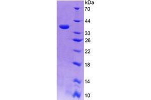 SDS-PAGE analysis of Human CISH Protein.