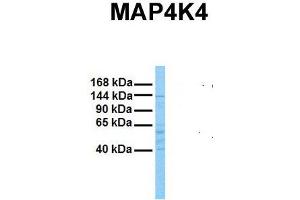 Host:  Rabbit  Target Name:  MAP4K4  Sample Tissue:  Human Stomach Tumor  Antibody Dilution:  1. (MAP4K4 antibody  (N-Term))
