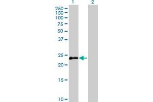 Western Blot analysis of OIP5 expression in transfected 293T cell line by OIP5 MaxPab polyclonal antibody. (OIP5 antibody  (AA 1-229))