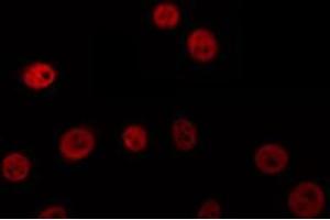 ABIN6274695 staining HuvEc by IF/ICC. (MSH3 antibody  (N-Term))
