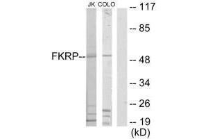 Western blot analysis of extracts from Jurkat cells and COLO205 cells, using FKRP antibody. (FKRP antibody  (N-Term))