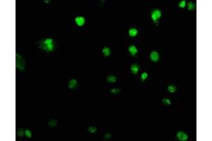 Immunofluorescence staining of U251 cells with ABIN7151309 at 1:100, counter-stained with DAPI. (UHRF2 antibody  (AA 444-585))