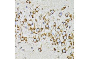 Immunohistochemistry of paraffin-embedded mouse brain using RPN1 antibody. (RPN1 antibody)