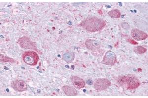 Anti-NPY1R antibody  ABIN1049122 IHC staining of human brain. (NPY1R antibody  (Cytoplasmic Domain))