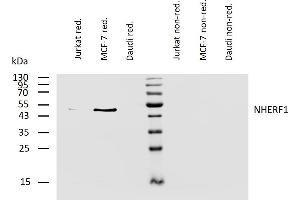 Western blotting analysis of human NHERF1 using mouse monoclonal antibody EBP-10 on lysates of Jurkat, MCF-7, and Daudi cells under reducing and non-reducing conditions. (SLC9A3R1 antibody)