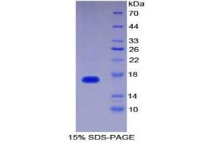 SDS-PAGE (SDS) image for Interleukin 1 delta (FIL1d) (AA 12-151) protein (His tag) (ABIN1525455)