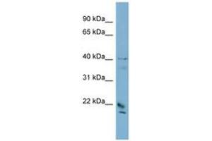 Image no. 1 for anti-DPY30 Domain Containing 1 (DYDC1) (C-Term) antibody (ABIN6741922) (DYDC1 antibody  (C-Term))