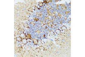 Immunohistochemistry of paraffin-embedded rat cerebellum using NEFH antibody (ABIN5974903) at dilution of 1/100 (40x lens).