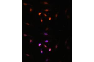 Immunofluorescence analysis of U2OS cells using KA antibody (ABIN7268768) at dilution of 1:100. (MYST3 antibody  (AA 800-1000))