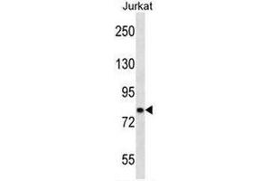 CACNB2 Antibody (Center) western blot analysis in Jurkat cell line lysates (35µg/lane). (CACNB2 antibody  (Middle Region))
