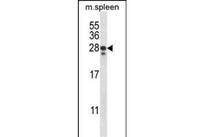 ANKRD22 Antibody (C-term) (ABIN657584 and ABIN2846587) western blot analysis in mouse spleen tissue lysates (35 μg/lane). (ANKRD22 antibody  (C-Term))