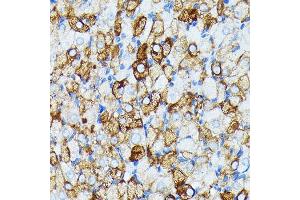 Immunohistochemistry of paraffin-embedded rat ovary using J Rabbit mAb (ABIN7268036) at dilution of 1:100 (40x lens). (JAK1 antibody)