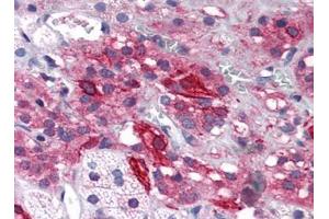Human Adrenal (formalin-fixed, paraffin-embedded) stained with GRIK1at 5 µg/ml followed by biotinylated goat anti-rabbit IgG secondary antibody, alkaline phosphatase-streptavidin and chromogen. (GRIK1 antibody  (Center))