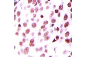 Immunohistochemistry (IHC) image for anti-Mdm2, p53 E3 Ubiquitin Protein Ligase Homolog (Mouse) (MDM2) antibody (ABIN7303804)