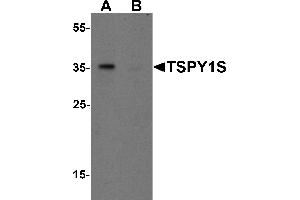 Western Blotting (WB) image for anti-TSPY1S (C-Term) antibody (ABIN1077409) (TSPY1S (C-Term) antibody)