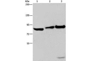 Western Blot analysis of NIH/3T3 cell, Mouse lung and liver tissue using MAPRE3 Polyclonal Antibody at dilution of 1:550 (ECE1 antibody)