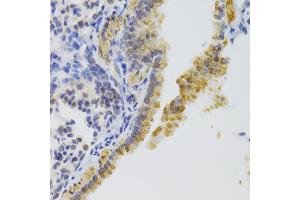 Immunohistochemistry of paraffin-embedded mouse lung using KIF1B Antibody (ABIN2563552) at dilution of 1:100 (40x lens). (KIF1B antibody)