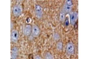 #VALUE! (PAK4 antibody  (AA 299-542))