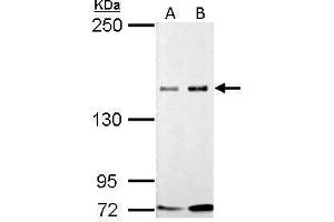WB Image GLI3 antibody detects GLI3 protein by Western blot analysis.