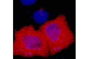 Immunofluorescent analysis of HA-tag staining in 293T cells transfected with a HA-tag protein. (HA-Tag antibody)