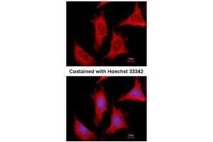ICC/IF Image Immunofluorescence analysis of methanol-fixed HeLa, using PPAT, antibody at 1:500 dilution. (PPAT antibody)