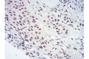 Immunohistochemistry (IHC) image for anti-Chromobox Homolog 3 (CBX3) (AA 1-183) antibody (ABIN5889677) (CBX3 antibody  (AA 1-183))