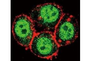 Confocal immunofluorescent analysis of PAK1 antibody with HeLa cells followed by Alexa Fluor 488-conjugated goat anti-rabbit lgG (green). (PAK1 antibody  (AA 401-430))
