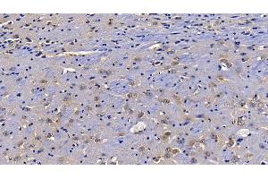 Detection of TOLLIP in Mouse Cerebrum Tissue using Polyclonal Antibody to Toll Interacting Protein (TOLLIP) (TOLLIP antibody  (AA 19-254))