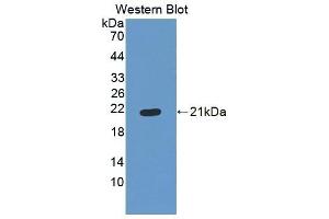 Detection of Recombinant ES, Human using Polyclonal Antibody to Endostatin (ES) (COL18A1 antibody  (AA 1154-1335))