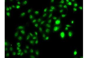 Immunofluorescence analysis of U2OS cells using CBFA2T2 antibody. (CBFA2T2 antibody  (AA 325-604))