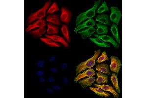 ABIN6264177 and ABIN6273064 staining Hela cells by IF/ICC.