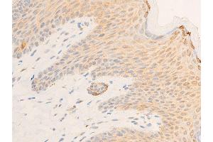 Immunohistochemistry (IHC) image for anti-Nuclear Factor of kappa Light Polypeptide Gene Enhancer in B-Cells Inhibitor, epsilon (NFKBIE) (pSer161) antibody (ABIN6255101)