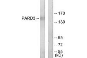 Western blot analysis of extracts from COLO205 cells, using PARD3 Antibody.