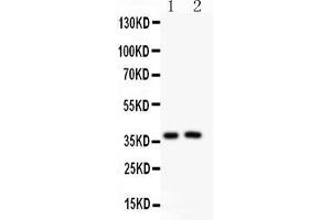 Anti-PD1 Picoband antibody , All lanes: Anti PD1  at 0. (PD-1 antibody  (AA 101-288))