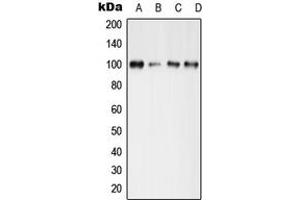 Western blot analysis of GLUR4 (pS862) expression in MCF7 Forskonlin-treated (A), mouse brain (B), mouse spleen (C), rat spleen (D) whole cell lysates. (GRIA4 antibody  (C-Term, pSer862))