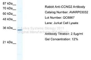 WB Suggested Anti-CCNG2 Antibody Titration: 2. (Cyclin G2 antibody  (N-Term))