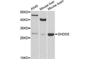Western blot analysis of extracts of various cell lines, using DHDDS antibody (ABIN5975201) at 1/1000 dilution.