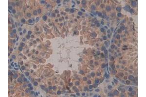 Detection of CNX in Mouse Testis Tissue using Polyclonal Antibody to Calnexin (CNX) (Calnexin antibody  (AA 263-482))