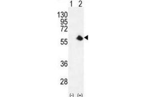 Western Blotting (WB) image for anti-Cyclin-Dependent Kinase 8 (CDK8) antibody (ABIN2996470) (CDK8 antibody)