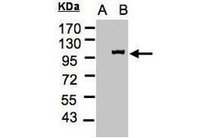 Western Blotting (WB) image for anti-Importin 13 (IPO13) (C-Term) antibody (ABIN2856550)