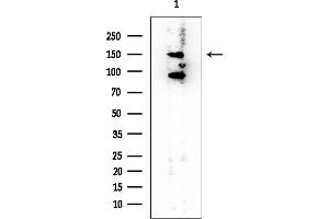anti-Protein Tyrosine Phosphatase F Interacting Protein 1 (PPFIA1) (C-Term) antibody