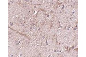 Immunohistochemistry of TOM70 in mouse brain tissue with this product at 2.