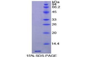 SDS-PAGE (SDS) image for Thymosin beta-4 (TMSB4X) (AA 1-44) protein (His tag) (ABIN1080922)