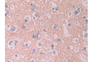 DAB staining on IHC-P;;Samples: Human Cerebrum Tissue (CYP1A2 antibody  (AA 2-231))