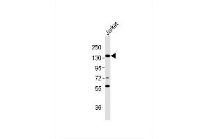 Anti-RB2 Antibody at 1:1000 dilution + Jurkat whole cell lysates Lysates/proteins at 20 μg per lane. (p130 antibody)