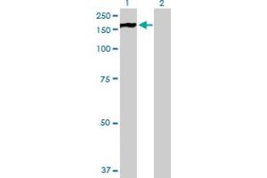 Western Blot analysis of PHKA2 expression in transfected 293T cell line by PHKA2 MaxPab polyclonal antibody. (PHKA2 antibody  (AA 1-1235))