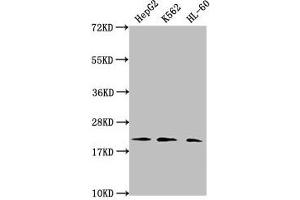 Western Blot Positive WB detected in: HepG2 whole cell lysate, K562 whole cell lysate, HL60 whole cell lysate All lanes: HIST1H1C antibody at 1:2000 Secondary Goat polyclonal to rabbit IgG at 1/40000 dilution Predicted band size: 22 kDa Observed band size: 22 kDa (HIST1H1C antibody  (2meLys45))