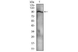 Nibrin 抗体  (AA 467-615)