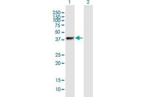Western Blot analysis of ZNF385B expression in transfected 293T cell line by ZNF385B MaxPab polyclonal antibody. (ZNF385B antibody  (AA 1-369))